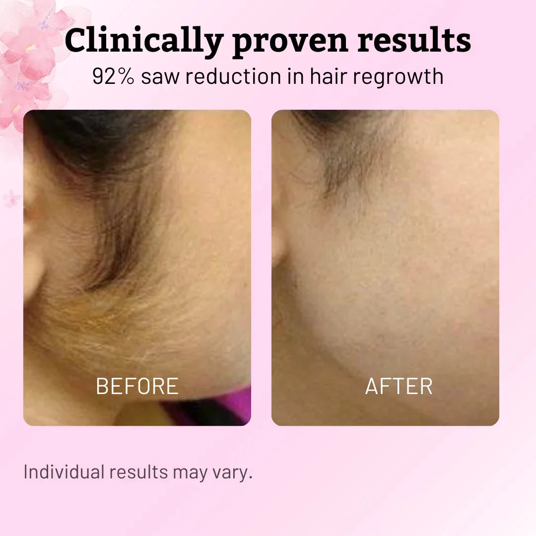 Cyperus Rotundus Oil for Natural Permanent Hair Reduction Luma Shop