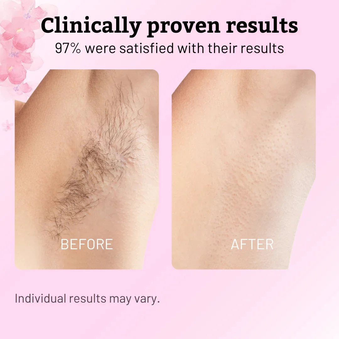 Cyperus Rotundus Oil for Natural Permanent Hair Reduction Luma Shop