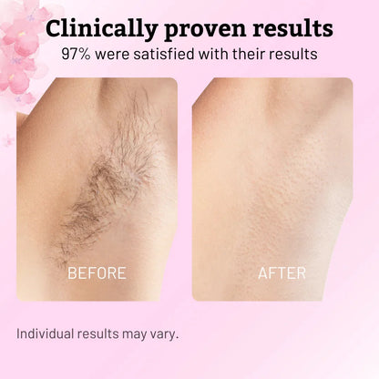 Cyperus Rotundus Oil for Natural Permanent Hair Reduction Luma Shop