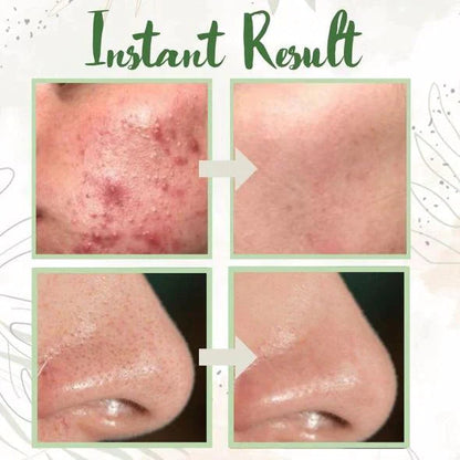 Green Tea Deep Cleanse Mask Luma Shop