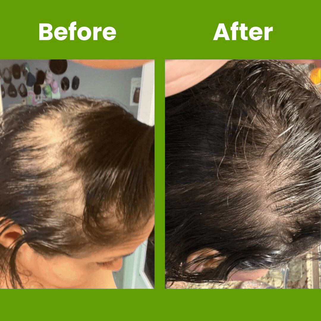 Hair Growth Serum Roll On Luma Shop