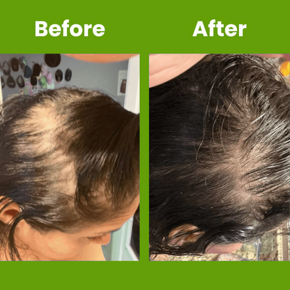 Hair Growth Serum Roll On Luma Shop