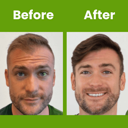 Hair Growth Serum Roll On Luma Shop