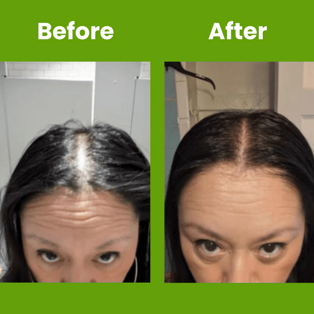 Hair Growth Serum Roll On Luma Shop