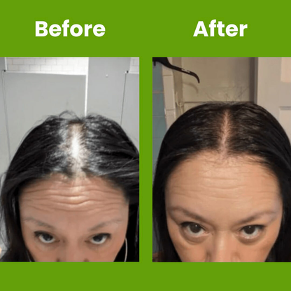 Hair Growth Serum Roll On Luma Shop