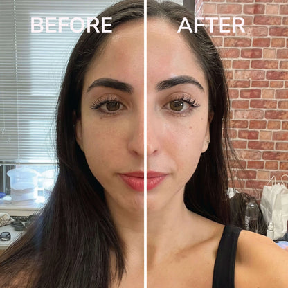 The Lymphatic Brush | Face Luma Shop